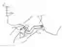 Fig. 01 - AUTOMATIC TRACHEOSTOMA SPEECH VALVE (ASTV) FIXATION BRACE