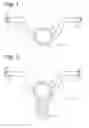 Fig. 02 - AUTOMATIC TRACHEOSTOMA SPEECH VALVE (ASTV) FIXATION BRACE