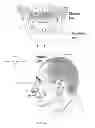 Fig. 06 - Mandibular repositioning device