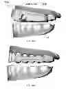 Fig. 19 - Mandibular repositioning device
