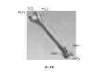 Fig. 20 - Mandibular repositioning device
