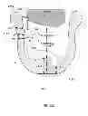 Fig. 24 - Mandibular repositioning device