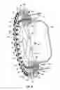 Fig. 15 - Apparatus and method for sealing a pipe including internal and external gripping means