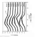 Fig. 09 - Iridium Oxide Coating with Cauliflower Morphology for Functional Electrical Stimulation Applications