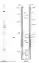Fig. 06 - Downhole tool impact dissipating tool