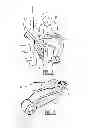 Fig. 02 - Stair lift