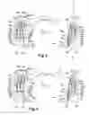 Fig. 03 - Disc brake comprising a brake pad preload spring