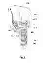Fig. 10 - Switch apparatus for vehicle