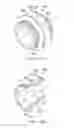 Fig. 14 - DIATOMACEOUS EARTH FILTER CLEANING TOOL WITH FLUID OSCILLATION NOZZLE AND DIATOMACEOUS EARTH CAPTURING SYSTEM