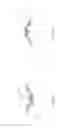 Fig. 76 - Electronic device holder with repositionable stand and systems and methods thereof