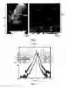 Fig. 04 - Method for manufacturing a thick epitaxial layer of gallium nitride on a silicon or similar substrate and layer obtained using said method