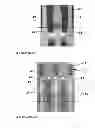 Fig. 07 - Micro lead frame structure having reinforcing portions and method