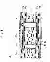 Fig. 02 - Semiconductor device and method of manufacturing the same