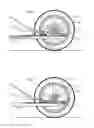 Fig. 07 - Device of Human Conveyance