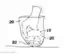 Fig. 01 - WASTE REMOVAL DEVICE
