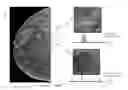 Fig. 01 - System and method for generating a 2D image using mammography and/or tomosynthesis image data