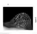 Fig. 04 - System and method for generating a 2D image using mammography and/or tomosynthesis image data