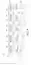 Fig. 14 - Fluid dispenser
