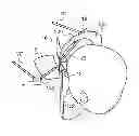 Fig. 01 - Device for determining at least one sight parameter of a subject in a plurality of viewing directions