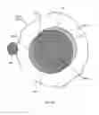 Fig. 32 - Orthovoltage radiotherapy