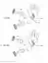 Fig. 40 - Orthovoltage radiotherapy