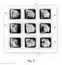 Fig. 04 - Medical imaging data processing apparatus and method