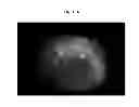 Fig. 23 - Medical imaging apparatus and method of controlling the same