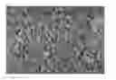 Fig. 02 - Carbon nanotubes and method for manufacturing the same