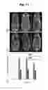 Fig. 07 - Biocompatible nanoparticles with aggregation induced emission characteristics as fluorescent bioprobes and methods of using the same for in vitro and in vivo imaging