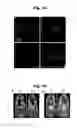 Fig. 09 - Biocompatible nanoparticles with aggregation induced emission characteristics as fluorescent bioprobes and methods of using the same for in vitro and in vivo imaging