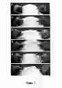 Fig. 02 - Use of 2,5-dihydroxybenzene derivatives for treating dermatitis