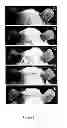 Fig. 07 - Use of 2,5-dihydroxybenzene derivatives for treating dermatitis