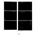 Fig. 03 - Accumulation of metabolic products in bacterial microcompartments