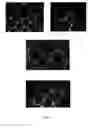 Fig. 04 - Strain of 