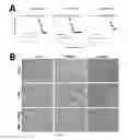 Fig. 05 - Method for treating or preventing graft versus host disease