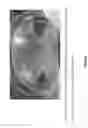 Fig. 09 - Energetic three-dimensional artificial cardiac patch and uses thereof