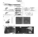 Fig. 06 - TECHNIQUE FOR ISOLATING/CULTURING COLORECTAL EPITHELIAL STEM CELL, AND TECHNIQUE FOR TRANSPLANTING COLORECTAL EPITHELIUM EMPLOYING SAID TECHNIQUE