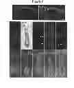 Fig. 07 - TECHNIQUE FOR ISOLATING/CULTURING COLORECTAL EPITHELIAL STEM CELL, AND TECHNIQUE FOR TRANSPLANTING COLORECTAL EPITHELIUM EMPLOYING SAID TECHNIQUE