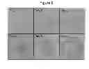 Fig. 08 - TECHNIQUE FOR ISOLATING/CULTURING COLORECTAL EPITHELIAL STEM CELL, AND TECHNIQUE FOR TRANSPLANTING COLORECTAL EPITHELIUM EMPLOYING SAID TECHNIQUE