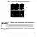 Fig. 03 - AGR2 blocking antibody and use thereof