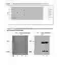 Fig. 07 - AGR2 blocking antibody and use thereof