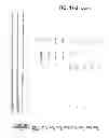Fig. 19 - Anti-integrin β1 antibody compositions and methods of use thereof