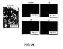 Fig. 34 - Anti-integrin β1 antibody compositions and methods of use thereof