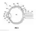 Fig. 04 - Methods for treating retinopathy with extended therapeutic effect