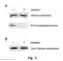 Fig. 06 - MITIGATION OF DISEASE BY INHIBITION OF GALECTIN-12