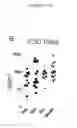 Fig. 14 - Human immunodeficiency virus neutralizing antibodies and methods of use thereof
