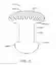 Fig. 11 - DRUG DELIVERY METHODS, STRUCTURES, AND COMPOSITIONS FOR NASOLACRIMAL SYSTEM