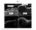Fig. 05 - Nano-Liposomal Formulations and Methods of Use
