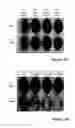 Fig. 14 - Liposomes co-encapsulating a bisphosphonate and an amphipathic agent