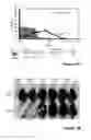 Fig. 15 - Liposomes co-encapsulating a bisphosphonate and an amphipathic agent